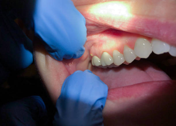 Best Broken or Cracked Tooth Emergency Dentist in Emerald Bay, TX