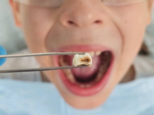 Best Emergency Dental Services for Seniors in Emerald Bay, TX